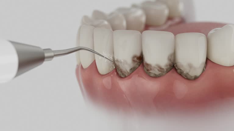 Trusted Dental Implants service in Rouse, CA - Dentist Open Now